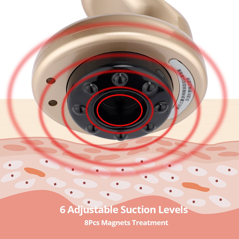Masajeador anticelulítico con ventosas al vacío, succión de ventosas, raspado Guasha, calefacción EMS, terapia magnética adelgazante para quemar grasas