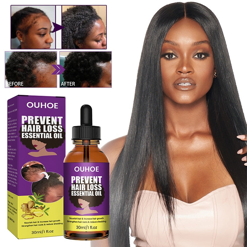 Africa Wild Ginger Hair Growth Essential Oil Crazy Hair Growth Traction Alopecia Hair Loss Prevent Edges Bald Spots Thinnin Hair