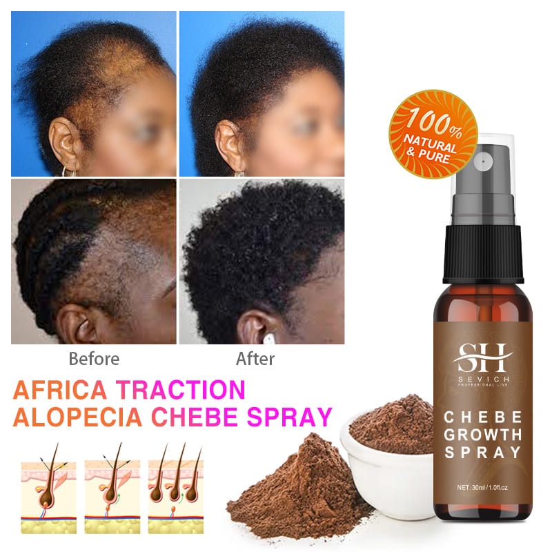 Poudre de Chebe pour hommes et femmes africaines, traitement de l'alopécie par Traction, Spray pour la croissance des cheveux, traitement contre la perte de cheveux, se débarrasser de la perruque, nouveauté 2023, 100g