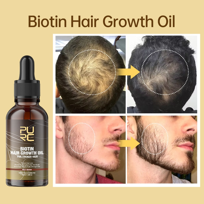 PURC productos para el crecimiento del cabello, aceite para el cabello con biotina, suero antipérdida de cabello de rápido crecimiento, tratamiento espesante para el cuero cabelludo para hombres y mujeres, cuidado del cabello