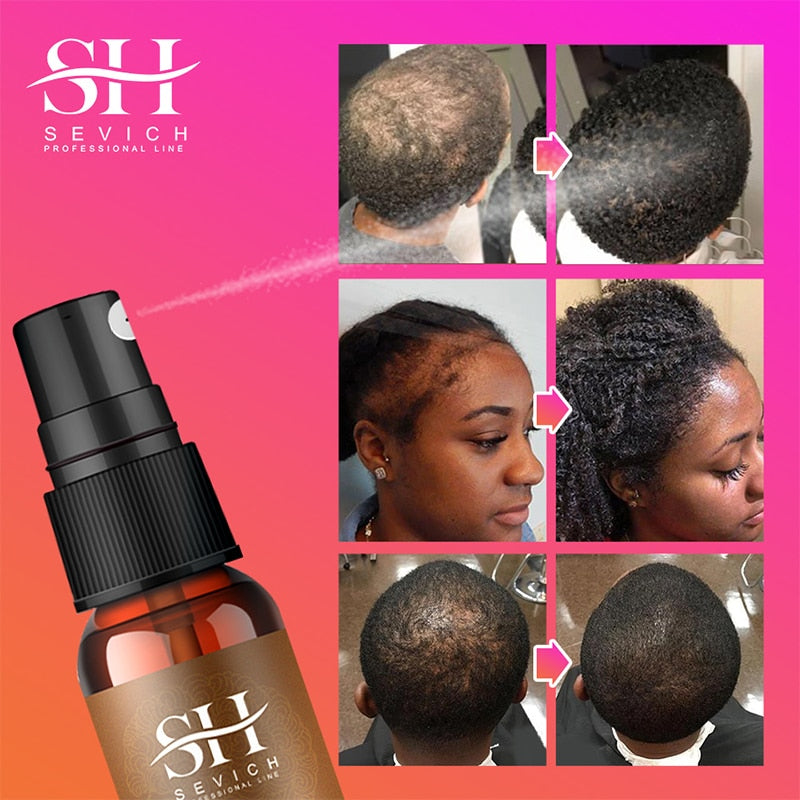 Sevich Chebe Hair Loss Treatment Spray Traction Alopecia Chebe Powder Essential Oil Africa Crazy Hair Growth Products Hair Care